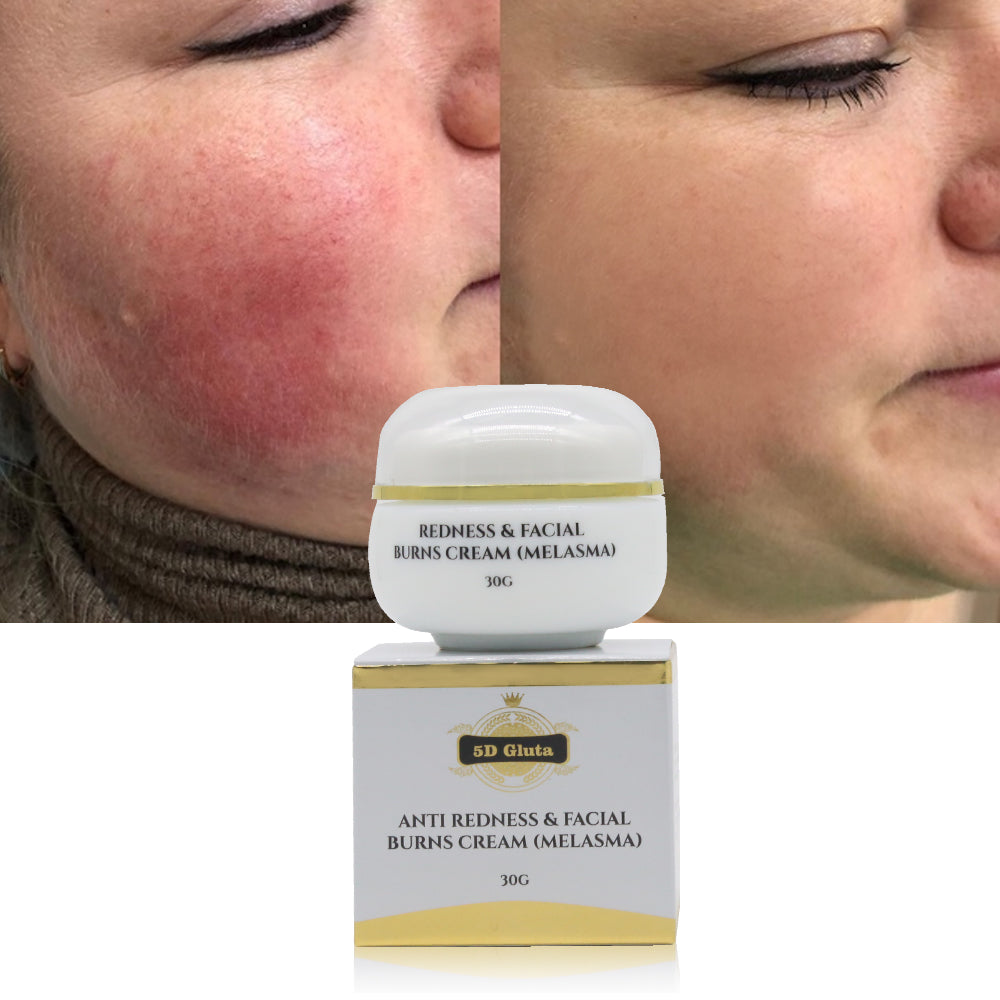 Crema Facial de pureza blanca 5D Gluta para mejorar las manchas oscuras del Melasma, manchas rojas, pecas, crema de belleza hidratante Facial