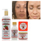 Goji Berries Glowing Skin Care Set Natural Whitening Brightening Non-irritating Skin Care Products for Dark Skin