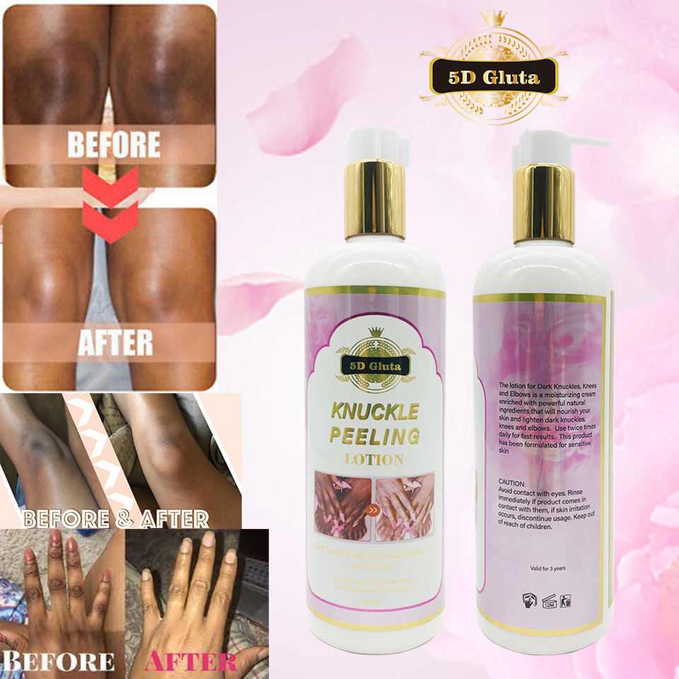 5D Gluta Dark Knuckle Remove Lotion for Body、Knees, elbows, joints
