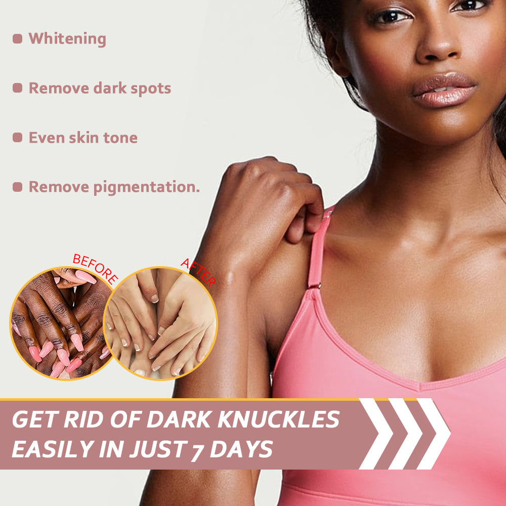 Sérum Miracle Knuckle pour les jointures foncées, genoux, coudes, peau africaine, produit de blanchiment rapide, alpha-arbutine en 7 jours